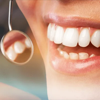 ¿Qué médico trata la periodontitis?